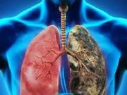 Hasta 200 casos de cáncer pulmonar se registran anualmente en Puebla