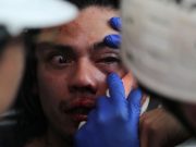 Cancelan uso de proyectiles de «goma» contra manifestantes en Chile La Cruz Roja informó que más de 2,500 han sido heridas durante las manifestaciones.