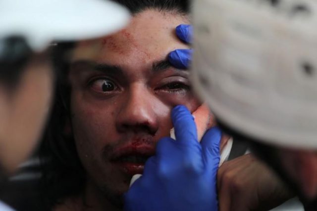 Cancelan uso de proyectiles de «goma» contra manifestantes en Chile La Cruz Roja informó que más de 2,500 han sido heridas durante las manifestaciones.