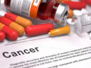 Niños con cáncer tienen asegurado su tratamiento en Puebla Expansión - El gobierno asegura que no hay manera de que los niños se queden sin tratamiento.