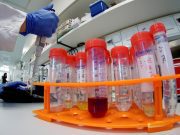 Detectan primer caso de coronavirus en Estados Unidos La Voz - Detectan primer caso de coronavirus en Estados Unidos