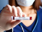 Científicos de Israel podrían tener lista vacuna contra el coronavirus en 10 semanas