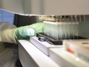 Aprueban fármaco para tratar el Alzheimer