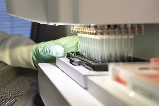 Aprueban fármaco para tratar el Alzheimer