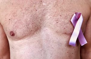 Detectan 189 casos de cáncer de mama en Sonora; 3 en varones