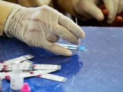 La CDXM registra 3 mil 330 casos positivos de VIH