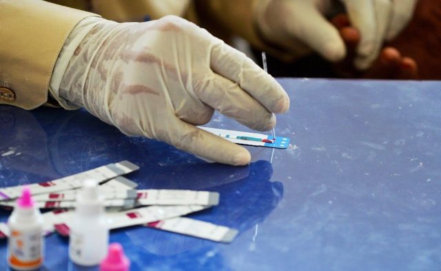 La CDXM registra 3 mil 330 casos positivos de VIH
