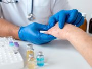 Termina emergencia por viruela del mono ¿Cómo evolucionó esta enfermedad?