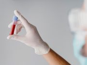 Cruz Roja Mexicana y AMIIF llaman a la donación voluntaria de sangre en todo el país