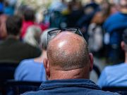 ¿Tendencia mundial? Estos son los países donde los hombres se están quedando calvos