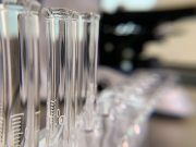 Biomarcador sanguíneo para predecir Alzheimer podría revolucionar su diagnóstico