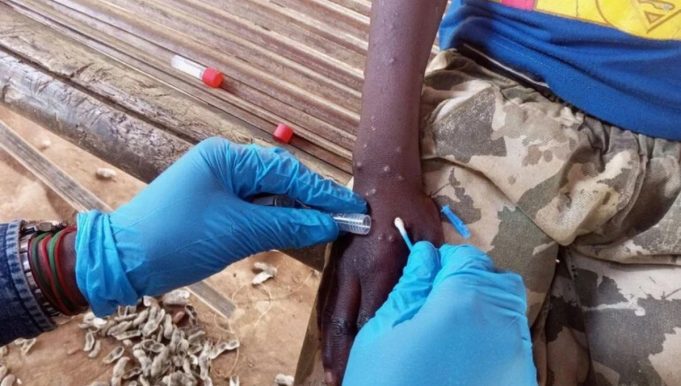 Vacunación contra la viruela sísmica