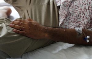 Detectan nuevo brote de viruela del mono en CDMX