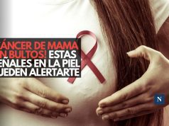 ¡Cáncer de mama sin bultos! Estas señales en la piel pueden alertarte