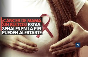 ¡Cáncer de mama sin bultos! Estas señales en la piel pueden alertarte